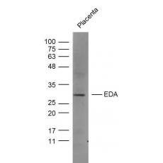 Anti-EDA antibody