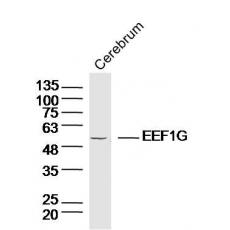 Anti-EEF1G antibody