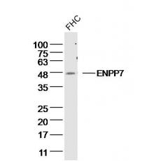 Anti-ENPP7 antibody