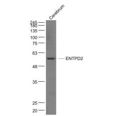 Anti-ENTPD2 antibody