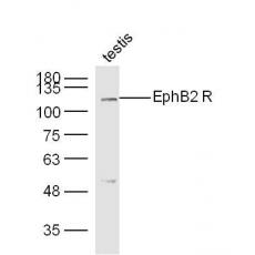 Anti-EphB2 antibody