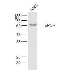 Anti-EPOR antibody