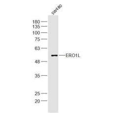 Anti-ERO1L antibody