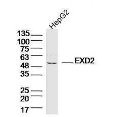 Anti-EXD2 antibody