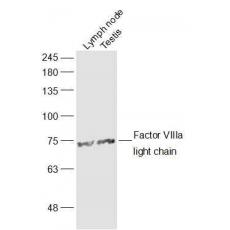 Anti-Factor VIIIa light chain antibody