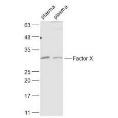 Anti-Factor X antibody