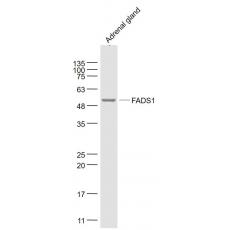 Anti-FADS1 antibody