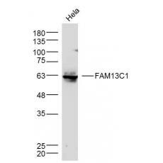 Anti-FAM13C1 antibody