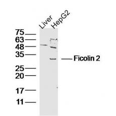 Anti-Ficolin 2 antibody