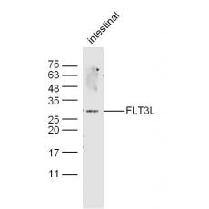 Anti-FLT3L antibody