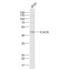 Anti-FLVCR antibody