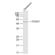 Anti-FOXG1 antibody