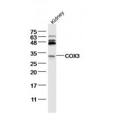 Anti-COX3 antibody