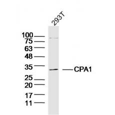 Anti-CPA1 antibody