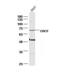 Anti-CROT antibody