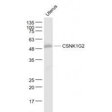 Anti-CSNK1G2 antibody