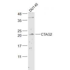 Anti-CTAG2 antibody