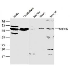 Anti-CRHR2 antibody