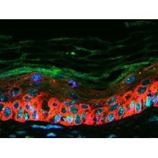 Anti-CXCL16 antibody