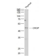 Anti-CROP antibody