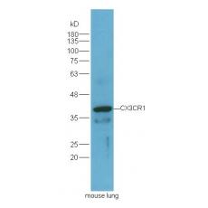 Anti-CX3CR1 antibody