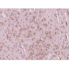 Anti-D4S234E antibody