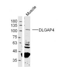 Anti-DLGAP4 antibody