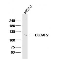 Anti-DLGAP2 antibody