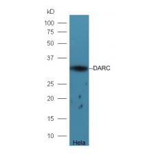 Anti-DHRS2 antibody