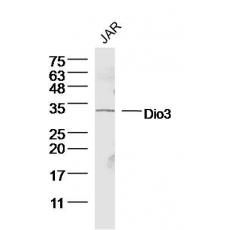 Anti-Dio3 antibody