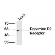 Anti-Dopamine D2 Receptor antibody