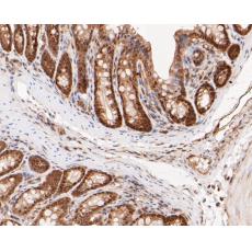 Anti-MTAP antibody