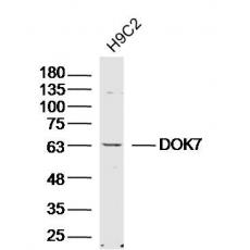 Anti-DOK7 antibody