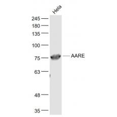 Anti-AARE antibody