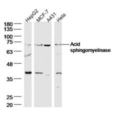 Anti-Acid sphingomyelinase antibody