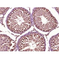 Anti-Acrosin antibody