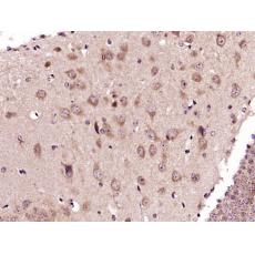 Anti-ADORA2B antibody