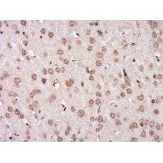 Anti-AGPAT1 antibody