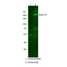 Anti-AKAP12 antibody