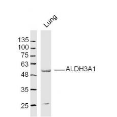 Anti-ALDH3A1 antibody