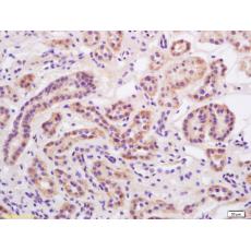 Anti-Alpha-ENaC antibody