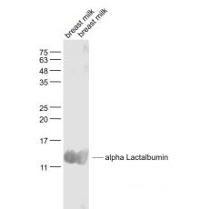 Anti-alpha Lactalbumin antibody