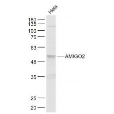Anti-AMIGO2 antibody