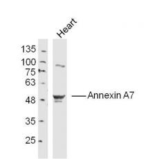 Anti-Annexin A7 antibody