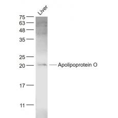 Anti-Apolipoprotein O antibody