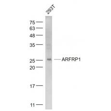 Anti-ARFRP1 antibody