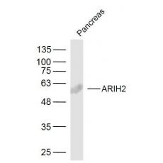 Anti-ARIH2 antibody