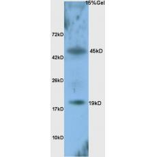 Anti-ATF3 antibody