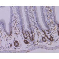 Anti-Ki67 antibody