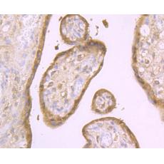 Anti-Aromatase antibody